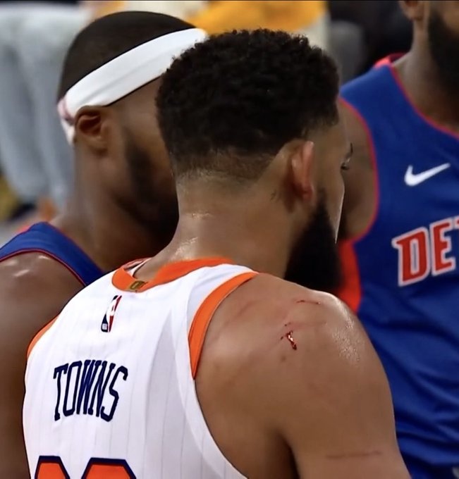 NBA赛场上演的\